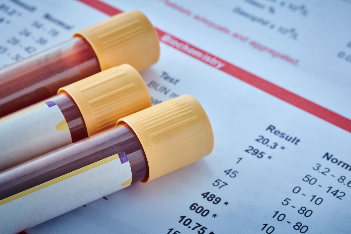 Blood test results and blood in tubes