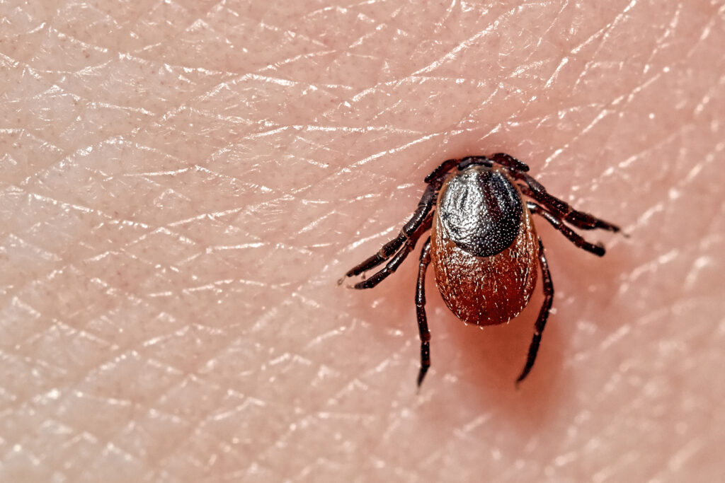 deer tick entering skin on human host showing risk of alpha gal syndrome and red meat allergy