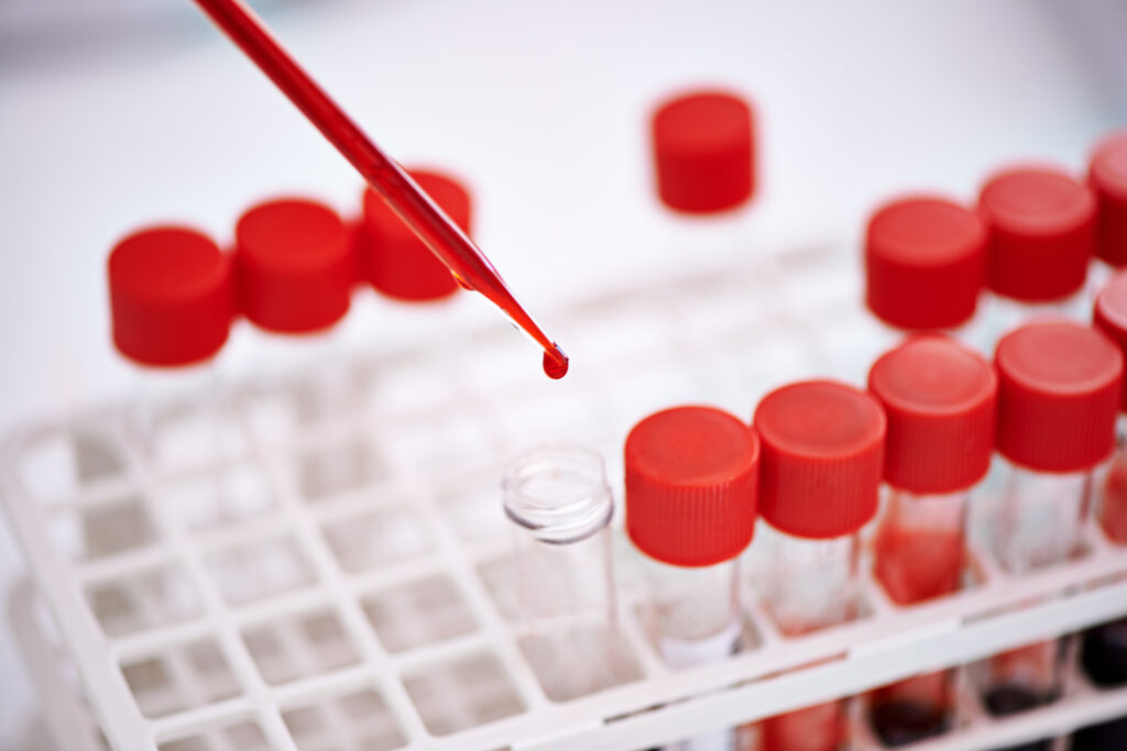 eye dropper adding one drop of red blood into a test tube in a tray of test tubes